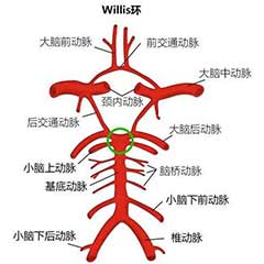 經(jīng)顱多普勒（TCD）可檢測(cè)的顱內(nèi)動(dòng)脈大盤點(diǎn)！