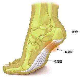 跟骨疼痛需謹(jǐn)慎骨密度